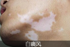 硿ҽɫƷ