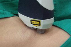 ݱҸʹް̣󼴿ɻؼҲסԺ